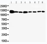 Anti-Vinculin/VCL Antibody Picoband® Boster Bio