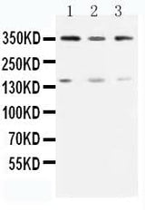 Anti-Serine-protein kinase ATM ATM Antibody Picoband® Boster Bio