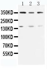 Anti-Serine-protein kinase ATM ATM Antibody Picoband® Boster Bio