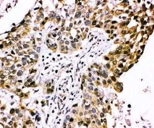 Anti-CISH Antibody Picoband® Boster Bio