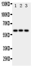 Anti-HEXA Antibody Picoband® Boster Bio