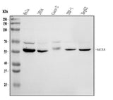 Anti-HEXA Antibody Picoband® Boster Bio