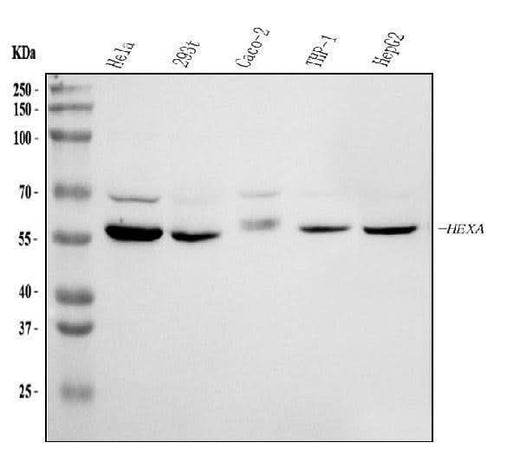 Anti-HEXA Antibody Picoband® Boster Bio