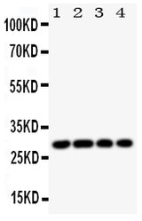 Anti-HLA DMB/HLA-DMB Antibody Picoband® Boster Bio