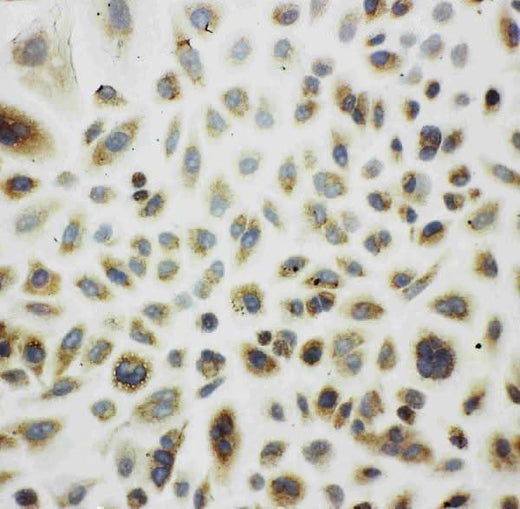 Anti-Cpn10/HSPE1 Antibody Picoband® Boster Bio