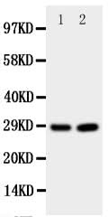 Anti-Prion protein PrP/PRNP Antibody Picoband® Boster Bio