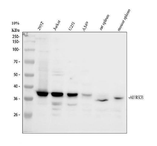Anti-Aurora B/AURKB Antibody Picoband® Boster Bio