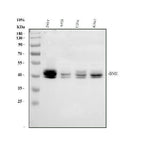 Anti-Polycomb complex protein BMI-1 Bmi1 Antibody Picoband® Boster Bio