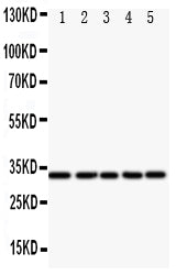 Anti-Transcription factor E2F6 E2F6 Antibody Picoband® Boster Bio