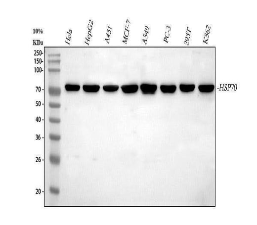 Anti-Hsp70/HSPA1A/HSPA1B Antibody Picoband® Boster Bio