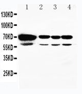 Anti-HSPA2 Antibody Picoband® Boster Bio