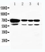 Anti-HSPA2 Antibody Picoband® Boster Bio