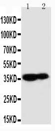 Anti-Kallikrein 9/KLK9 Antibody Picoband® Boster Bio