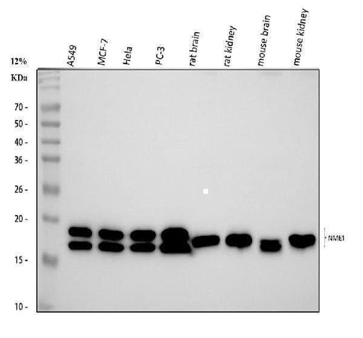 Anti-NM23A/NME1 Antibody Picoband® Boster Bio