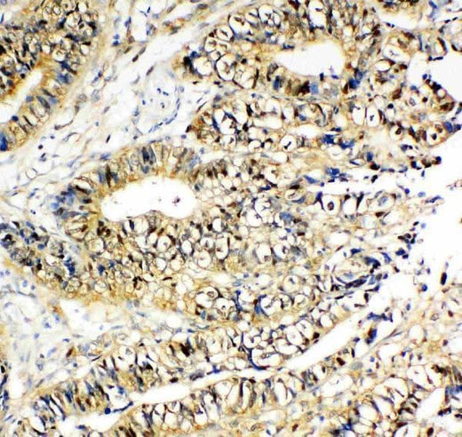Anti-NME2 Antibody Picoband® Boster Bio