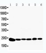Anti-Peroxiredoxin 2/PRDX2 Antibody Picoband® Boster Bio