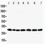 Anti-Peroxiredoxin 4/PRDX4 Antibody Picoband® Boster Bio