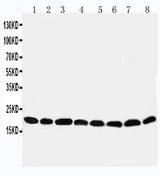 Anti-Peroxiredoxin 5/PRDX5 Antibody Picoband® Boster Bio
