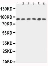 Anti-STAT5b Antibody Picoband® Boster Bio