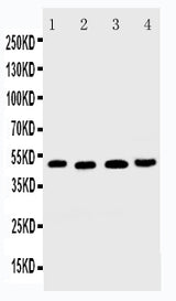 Anti-DR5/TNFRSF10B Antibody Picoband® Boster Bio