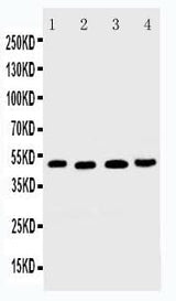 Anti-DR5/TNFRSF10B Antibody Picoband® Boster Bio