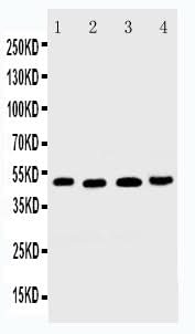Anti-DR5/TNFRSF10B Antibody Picoband® Boster Bio