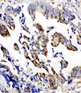 Anti-Beta Arrestin 2/ARRB2 Antibody Picoband® Boster Bio
