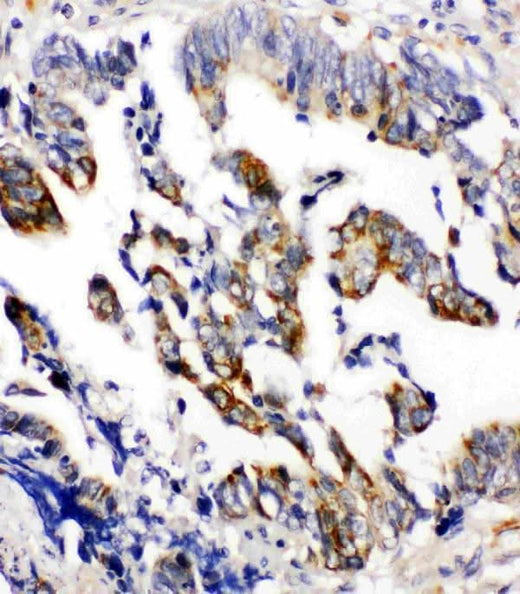 Anti-Beta Arrestin 2/ARRB2 Antibody Picoband® Boster Bio