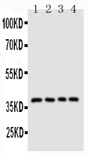 Anti-CD1d Antibody Picoband® Boster Bio