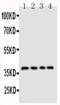 Anti-CD1d Antibody Picoband® Boster Bio
