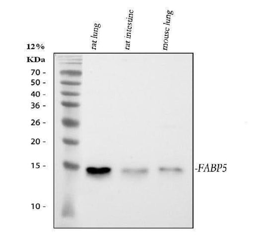 Anti-Fatty Acid Binding Protein 5/FABP5 Antibody Picoband® Boster Bio