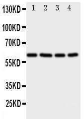 Anti-RIP2/RIPK2 Antibody Picoband® Boster Bio