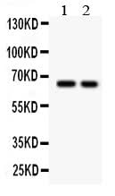 Anti-TGF beta Receptor II/TGFBR2 Antibody Picoband® Boster Bio