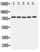 Anti-ABCG1 Antibody Picoband® Boster Bio