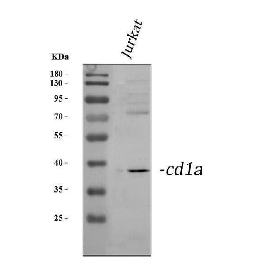Anti-CD1a Antibody Picoband® Boster Bio