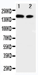 Anti-ErbB 4/ERBB4 Antibody Picoband® Boster Bio