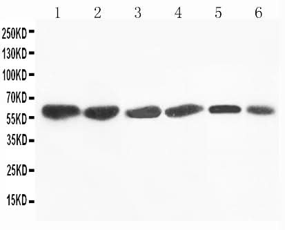 Anti-Flavin containing monooxygenase 4/FMO4 Antibody Picoband® Boster Bio