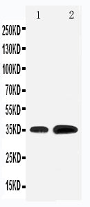 Anti-Krueppel-like factor 3 KLF3 Antibody Picoband® Boster Bio
