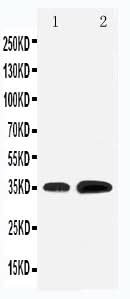 Anti-Krueppel-like factor 3 KLF3 Antibody Picoband® Boster Bio