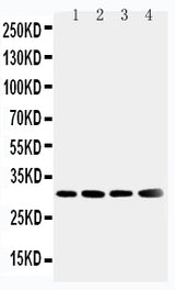 Anti-Superoxide Dismutase 3/SOD3 Antibody Picoband® Boster Bio