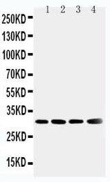 Anti-Superoxide Dismutase 3/SOD3 Antibody Picoband® Boster Bio
