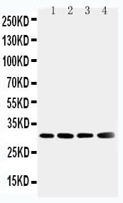 Anti-Superoxide Dismutase 3/SOD3 Antibody Picoband® Boster Bio