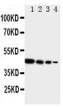 Anti-TRIF/TICAM1 Antibody Picoband® Boster Bio