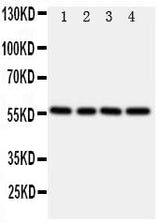 Anti-TXNRD2 Antibody Picoband® Boster Bio
