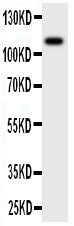 Anti-MCSF Receptor/CSF1R Antibody Picoband® Boster Bio