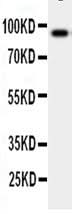 Anti-GCSF Receptor/CSF3R Antibody Picoband® Boster Bio