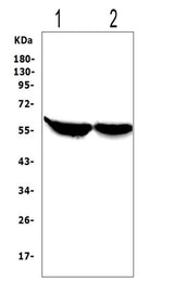 Anti-Cytochrome P450 2E1/CYP2E1 Antibody Picoband® Boster Bio