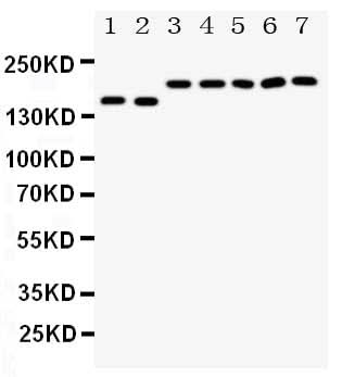 Anti-Netrin receptor DCC DCC Antibody Picoband® Boster Bio