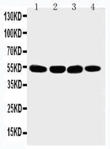 Anti-Matrilin 3/MATN3 Antibody Picoband® Boster Bio