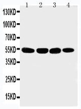 Anti-Matrilin 3/MATN3 Antibody Picoband® Boster Bio